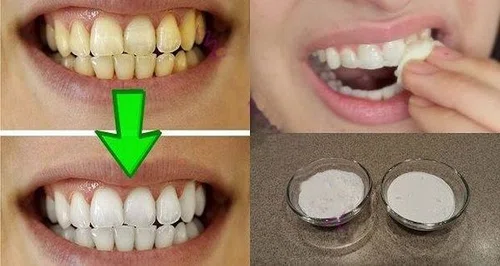 Domowe i skuteczne wybielanie zębów! 2 naturalne składniki