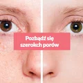 Pozbądź się szerokich porów za pomocą kilku domowych składników!
