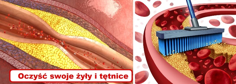Ta receptura oczyści Twoje TĘTNICE i ochroni Cię przed zawałem!