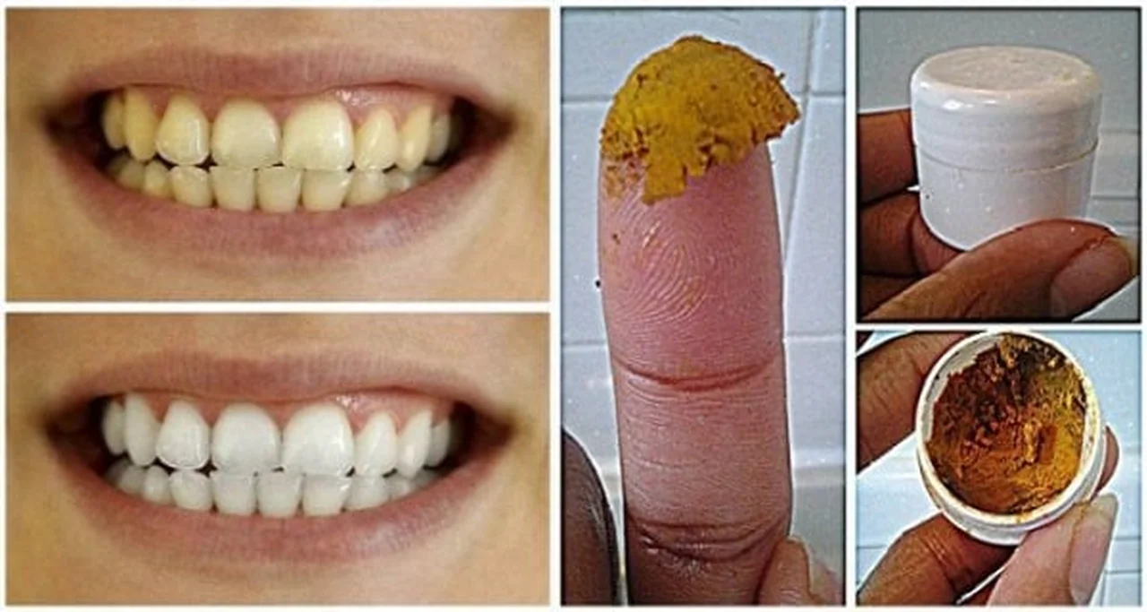 Domowy i skuteczny trik, dzięki któremu pozbędziesz się przebarwień na zębach