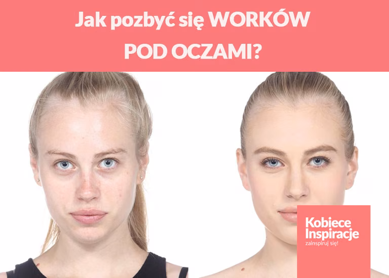 Jak pozbyć się WORKÓW POD OCZAMI?