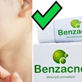 Benzacne - HIT z apteki na zaskórniki za kilkanaście zł!