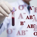 Czy grupa krwi wpływa na choroby? Tak! Sprawdź jak