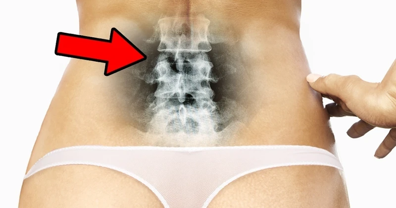 3 ćwiczenia na doskonałą postawę ciała