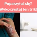 Poparzyłaś się? Wykorzystaj ten trik!