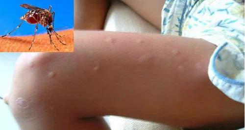 Jak przygotować naturalny i skuteczny spray na komary?