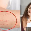 Masz te objawy? To może być alergia. Sprawdź, na co możesz być uczulony